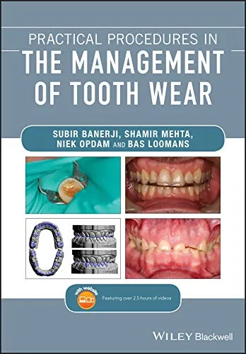 Coperta cărții "Practical Procedures in the Management of Tooth Wear" de Subir Banerji, Shamir B. Mehta, Niek Opdam, Bas Loomans