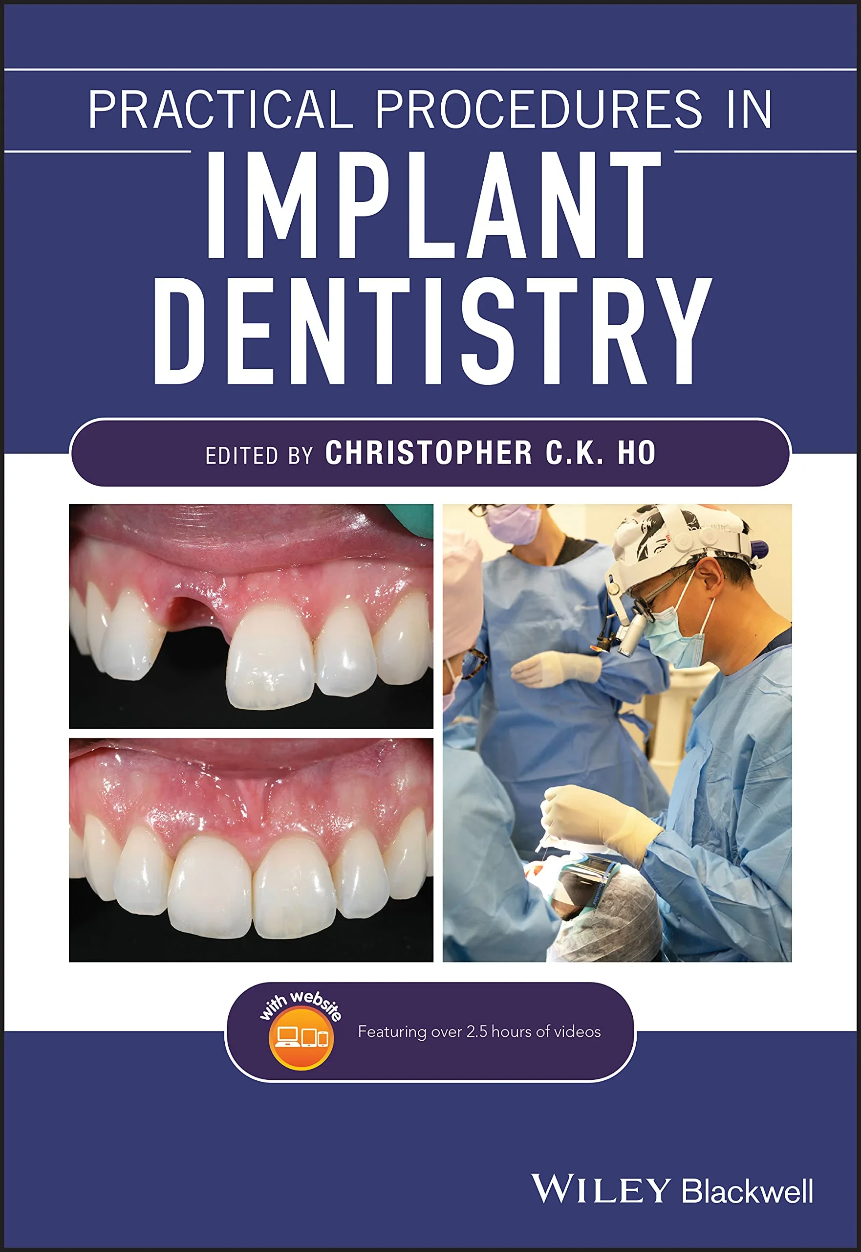 Coperta cărții "Practical Procedures in Implant Dentistry" de Christopher C. K. Ho