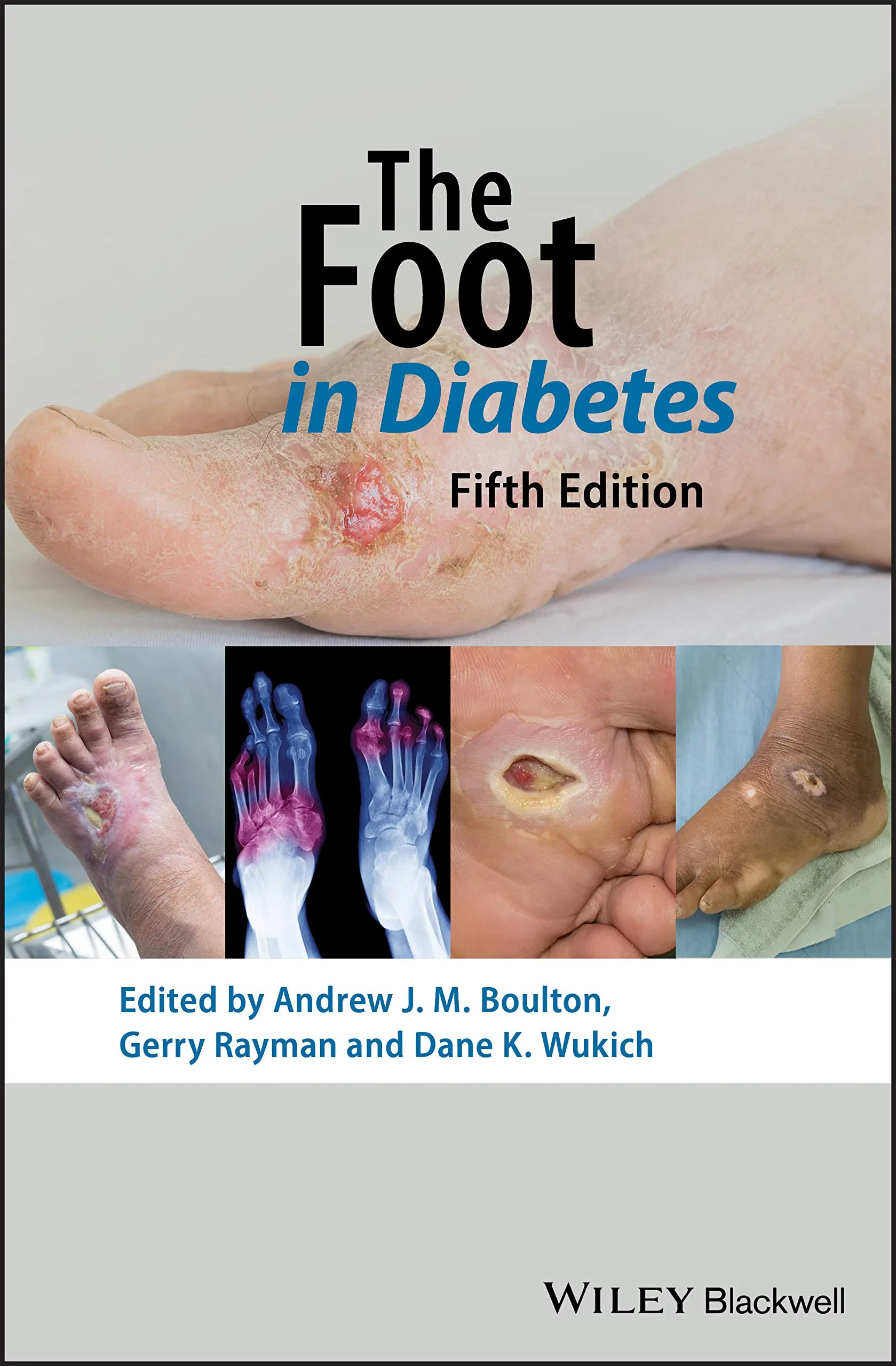 Coperta cărții "The Foot in Diabetes " de AJM Boulton