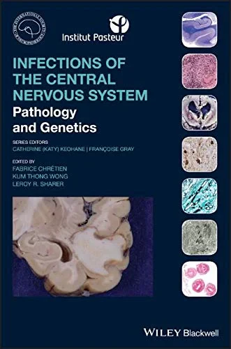 Infections of the Central Nervous System: Patholog...