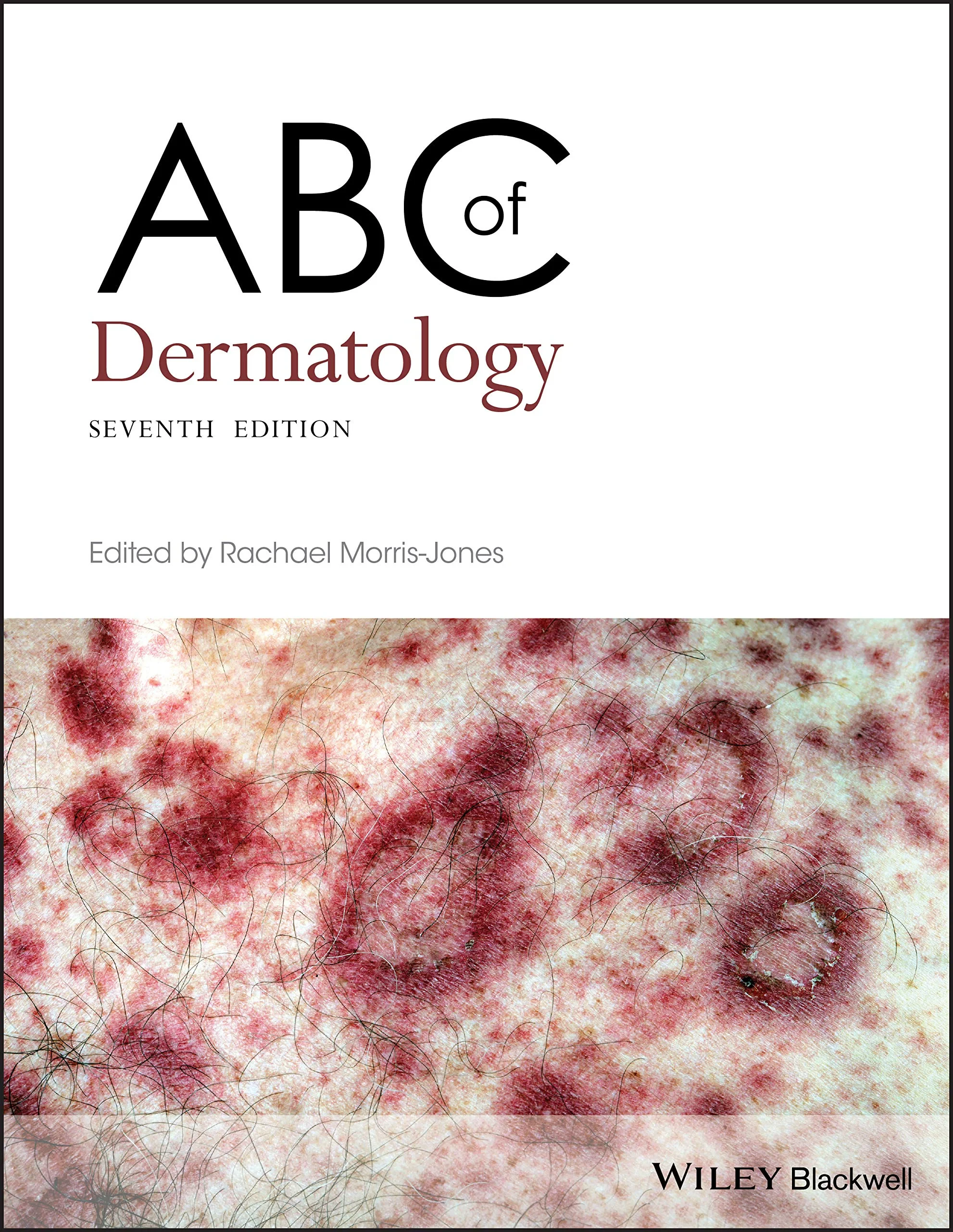 Coperta cărții "ABC of Dermatology, 7th Edition" de Rachael Morris&amp;#150;Jones, Rachael Morris–Jones