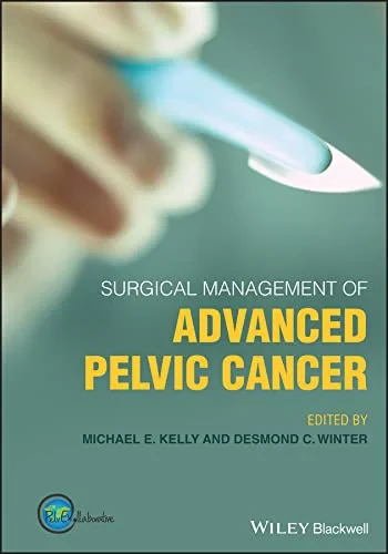 Coperta cărții "Surgical Management of Advanced Pelvic Cancer" de Desmond C. Winter, Michael E. Kelly