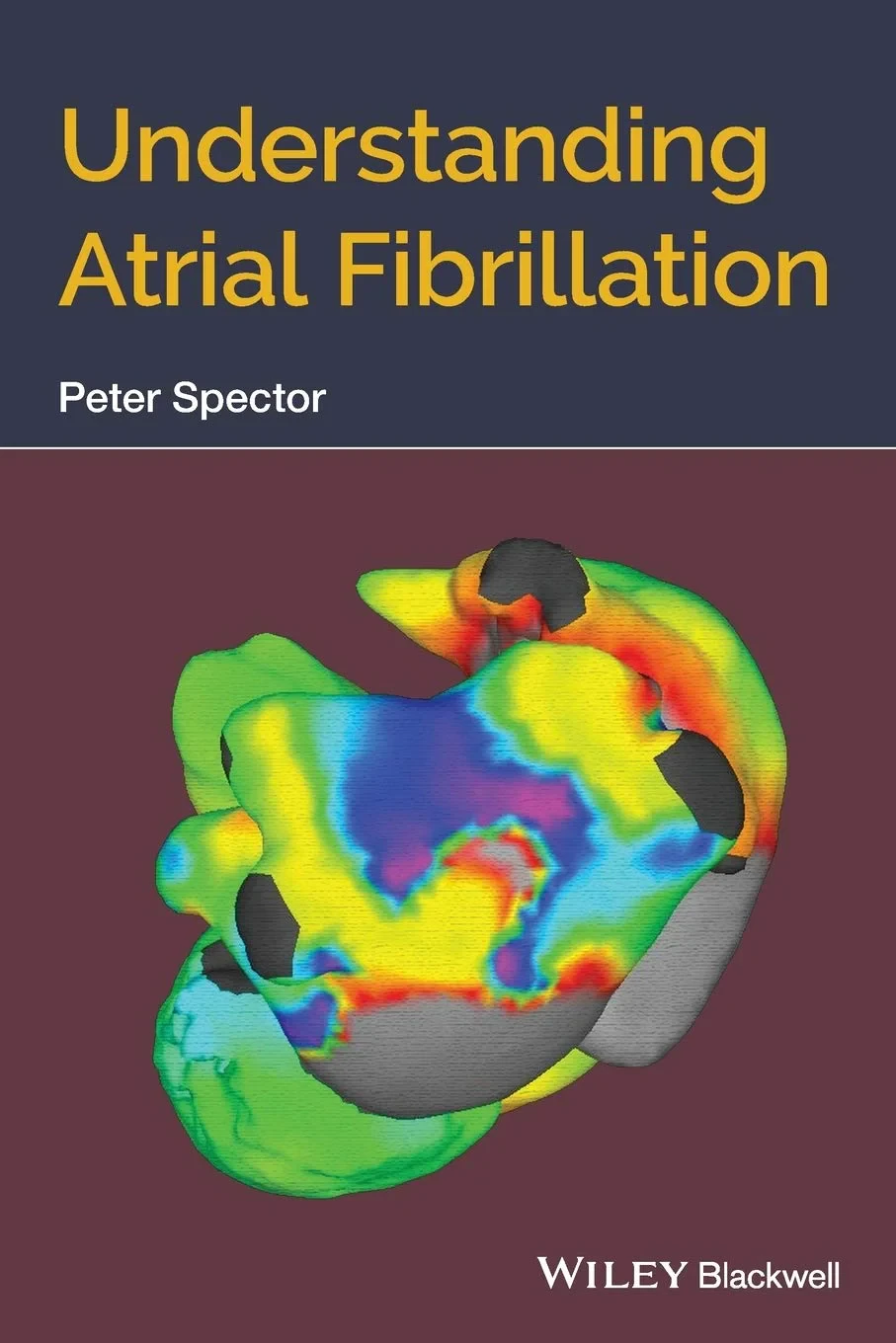 Coperta cărții "Understanding Atrial Fibrillation" de Peter Spector