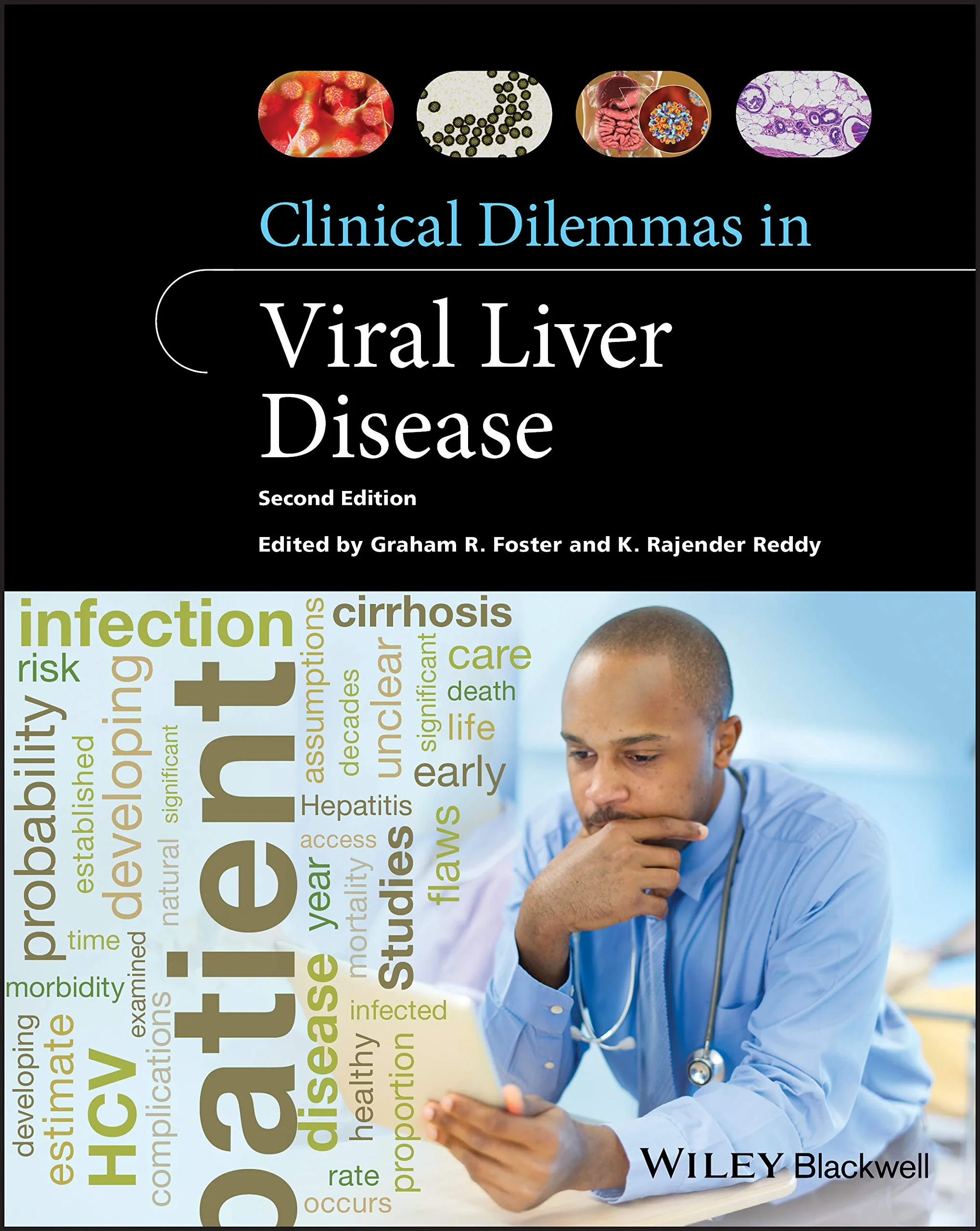 Coperta cărții "Clinical Dilemmas in Viral Liver Disease" de K. Rajender Reddy, Graham R. Foster