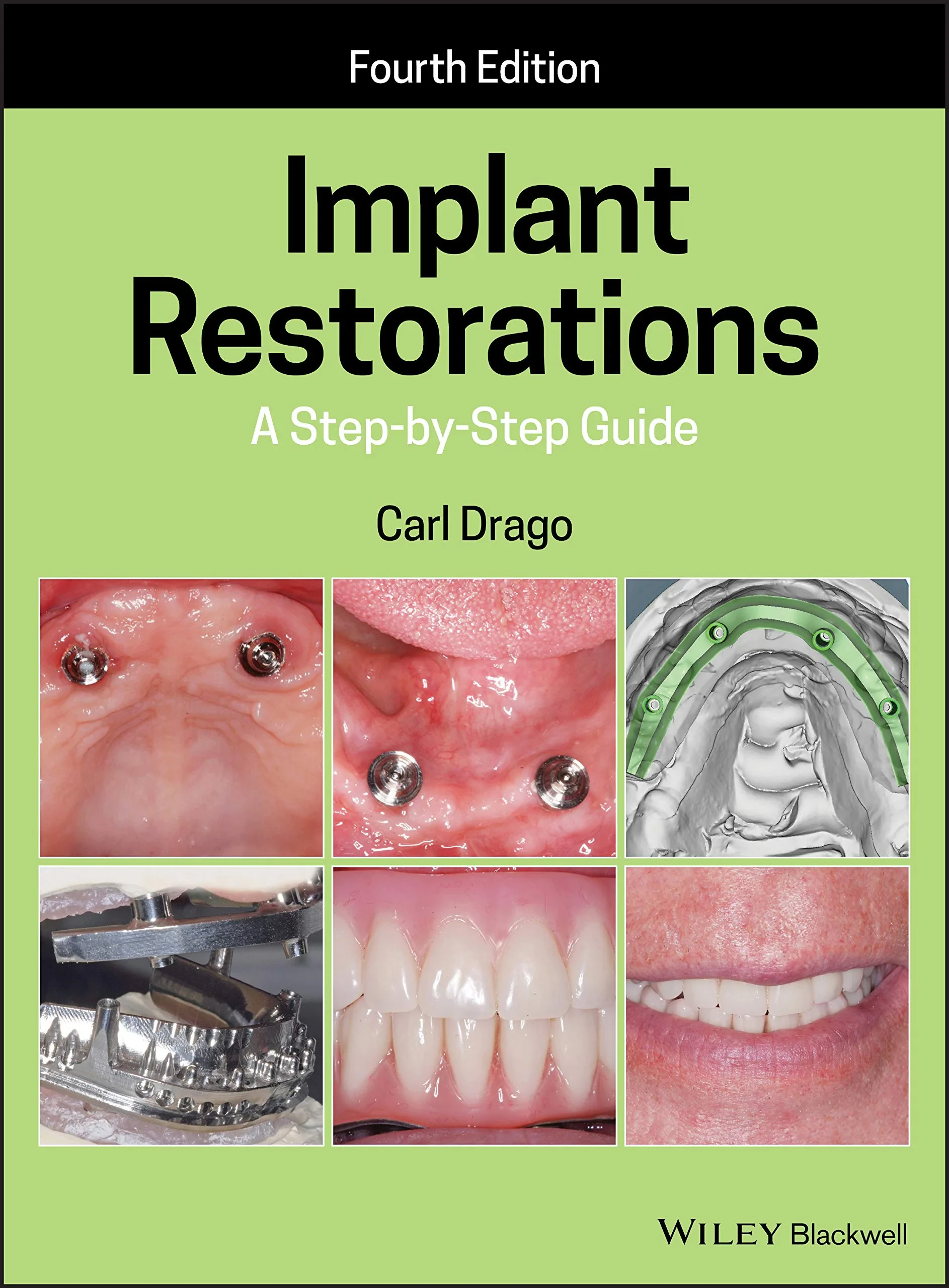 Coperta cărții "Implant Restorations: A Step-by-Step Guide" de Carl Drago