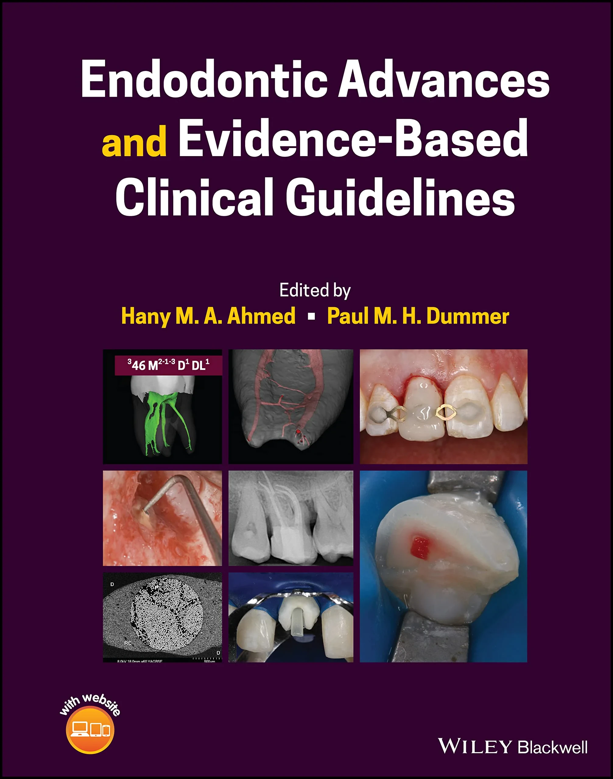 Coperta cărții "Endodontic Advances and Evidence-Based Clinical Guidelines" de Hany M. A. Ahmed, Paul M. H. Dummer