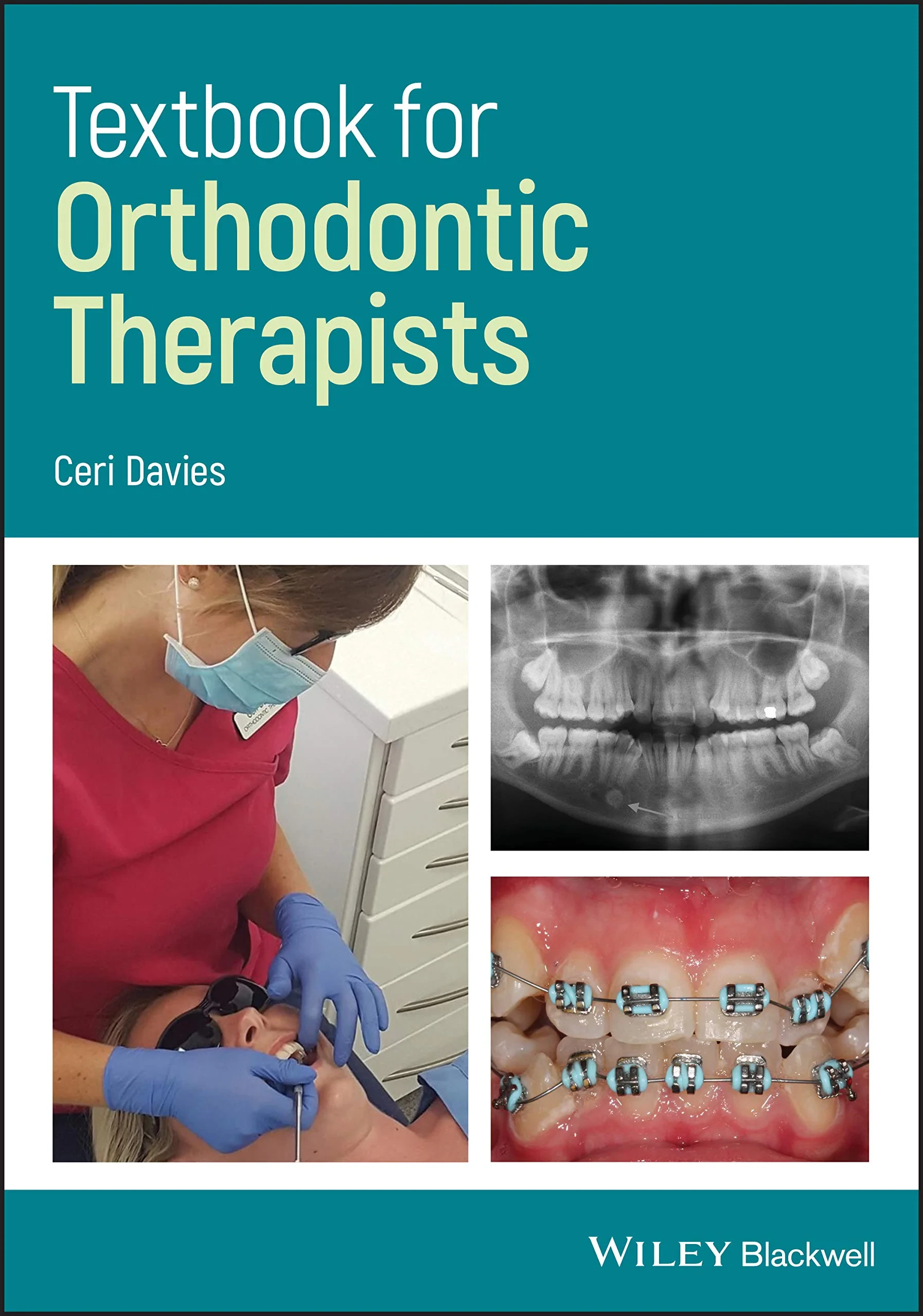Coperta cărții "Textbook for Orthodontic Therapists " de Ceri Davies