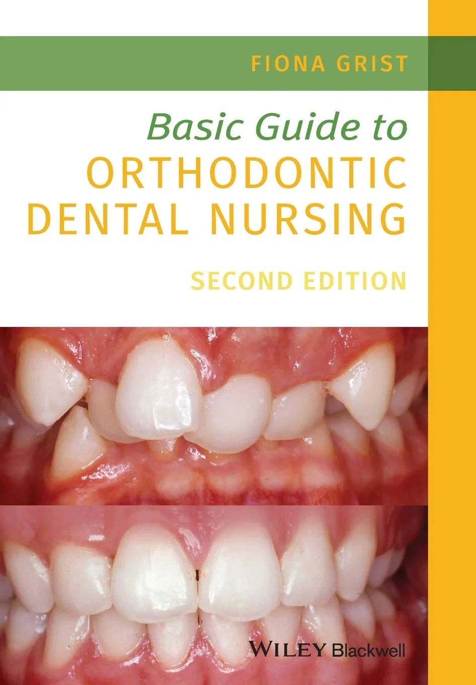 Coperta cărții "Basic Guide to Orthodontic Dental Nursing 2nd Edition" de Fiona Grist