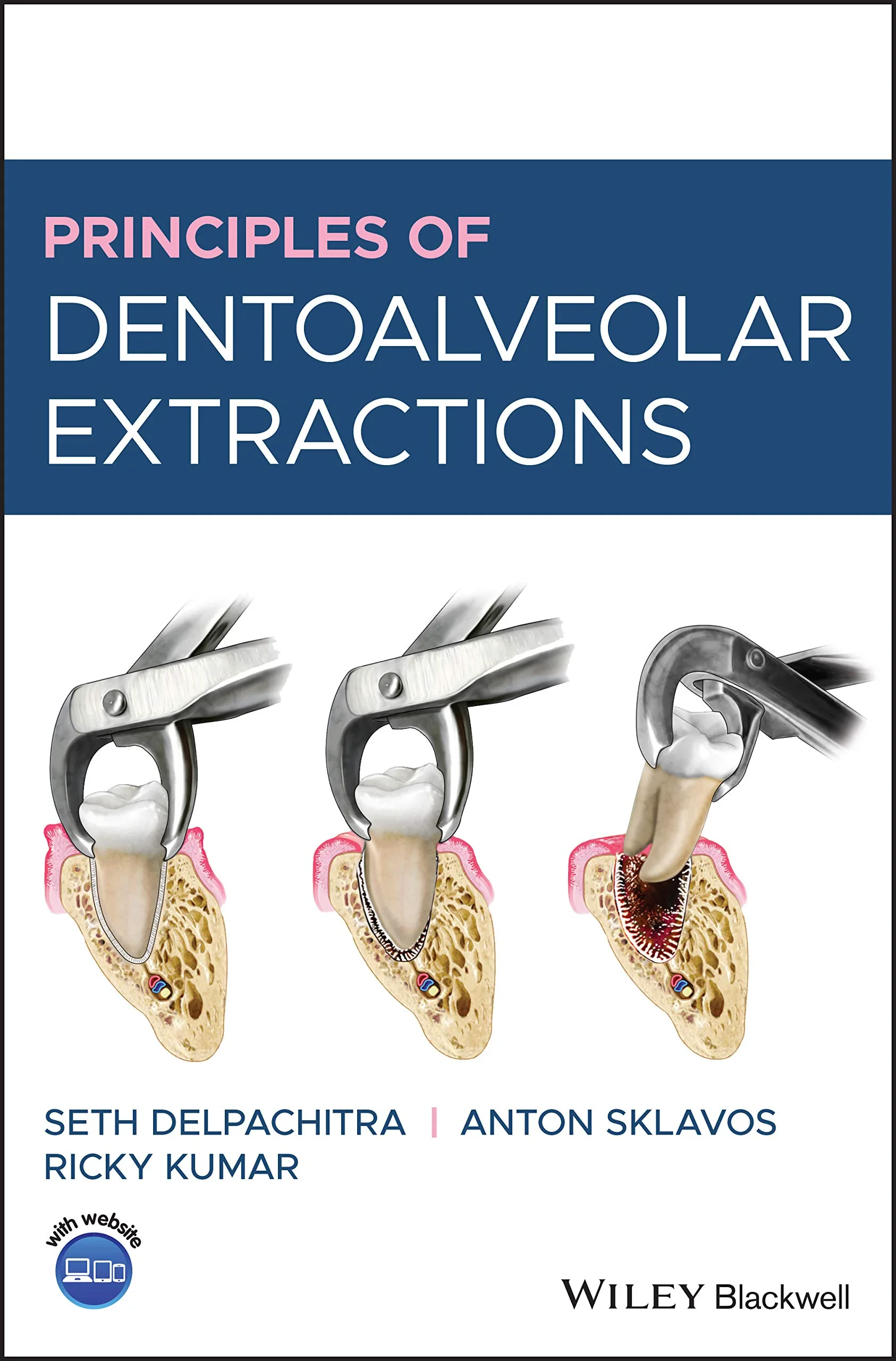 Coperta cărții "Principles of Dentoalveolar Extractions" de Seth Delpachitra, Anton Sklavos, Ricky Kumar