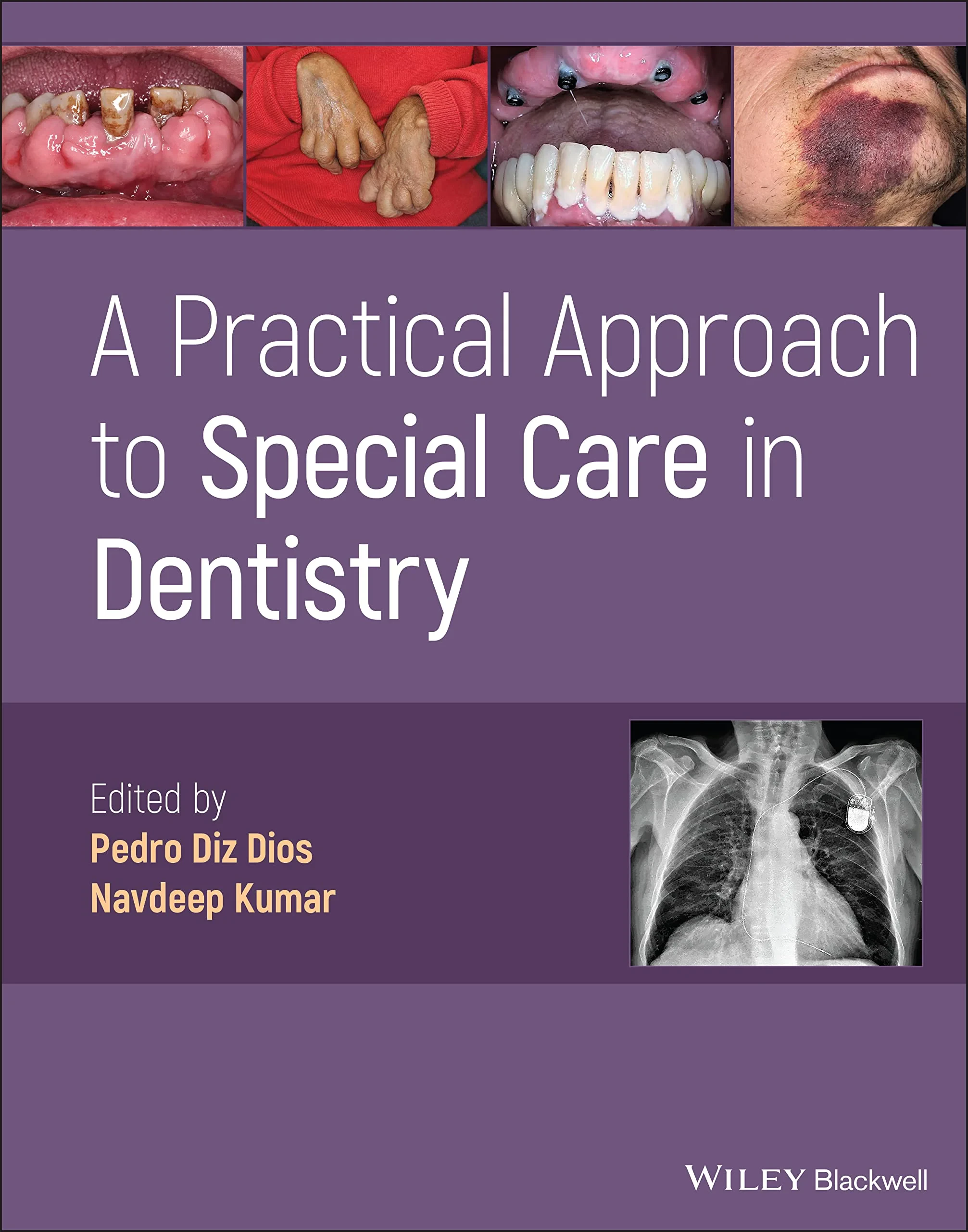 Coperta cărții "A Practical Approach to Special Care in Dentistry" de Pedro Diz Dios, Navdeep Kumar