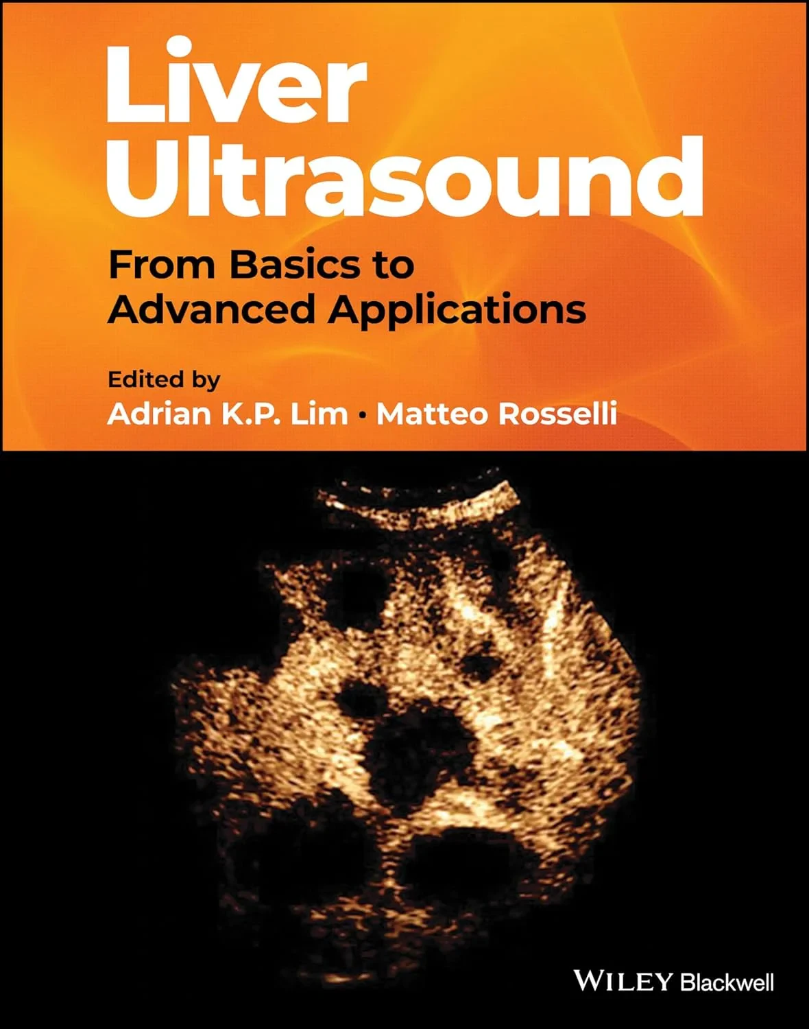 Coperta cărții "Liver Ultrasound: From Basics to Advanced Applications" de A Lim