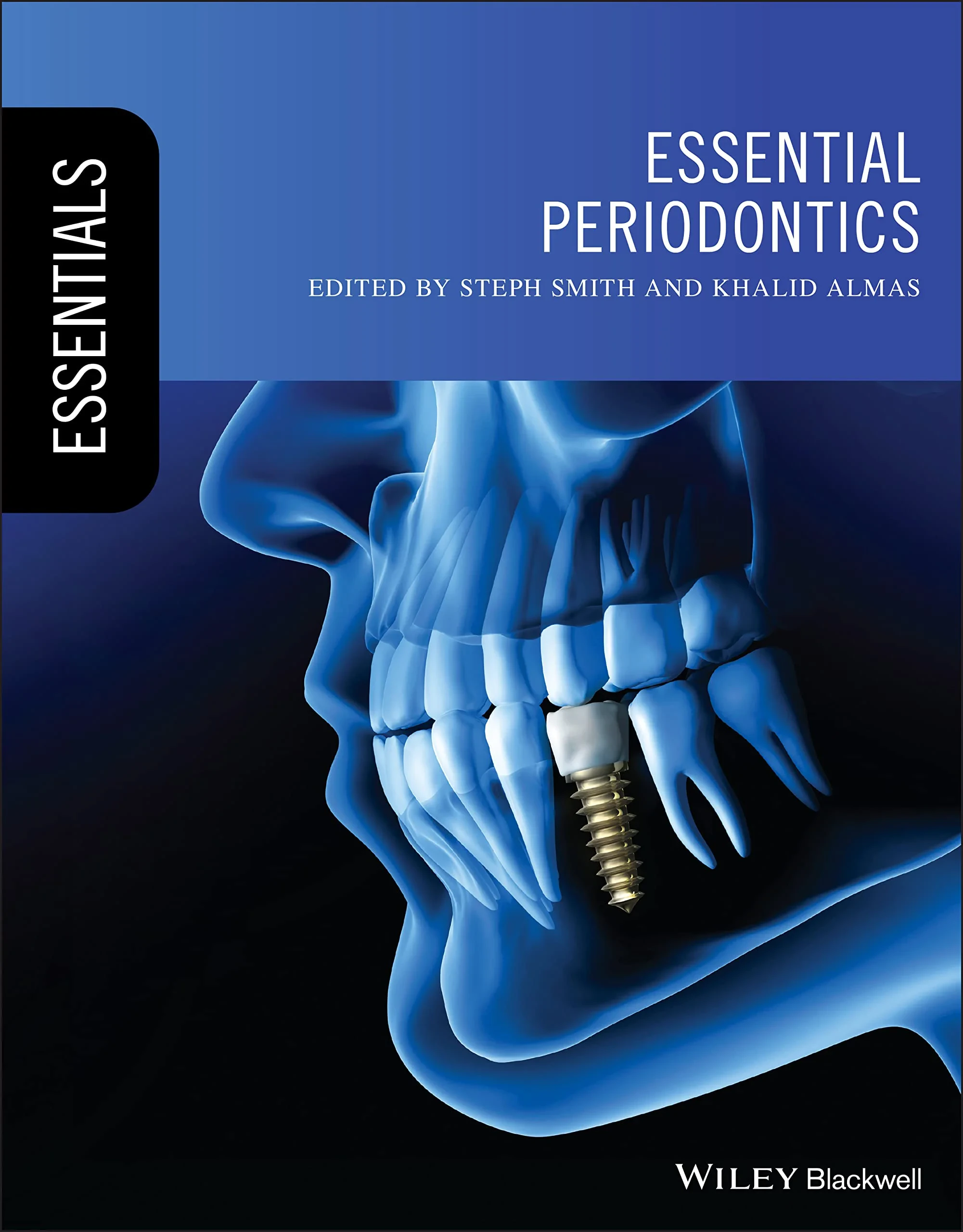 Coperta cărții "Essential Periodontics" de Khalid Almas, Steph Smith