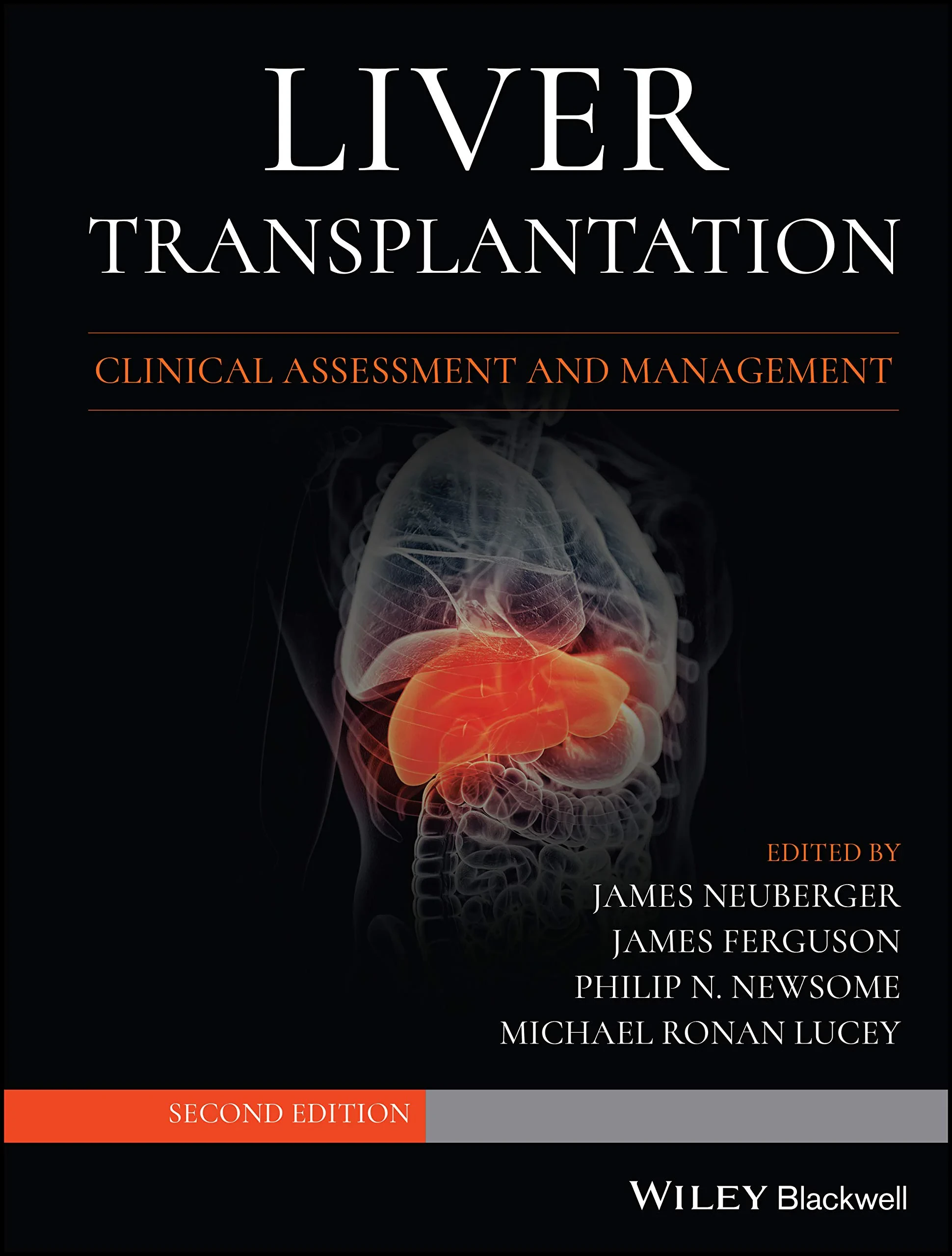 Coperta cărții "Liver Transplantation: Clinical Assessment and Management" de James Neuberger, James Ferguson, Philip N. Newsome, Michael R. Lucey