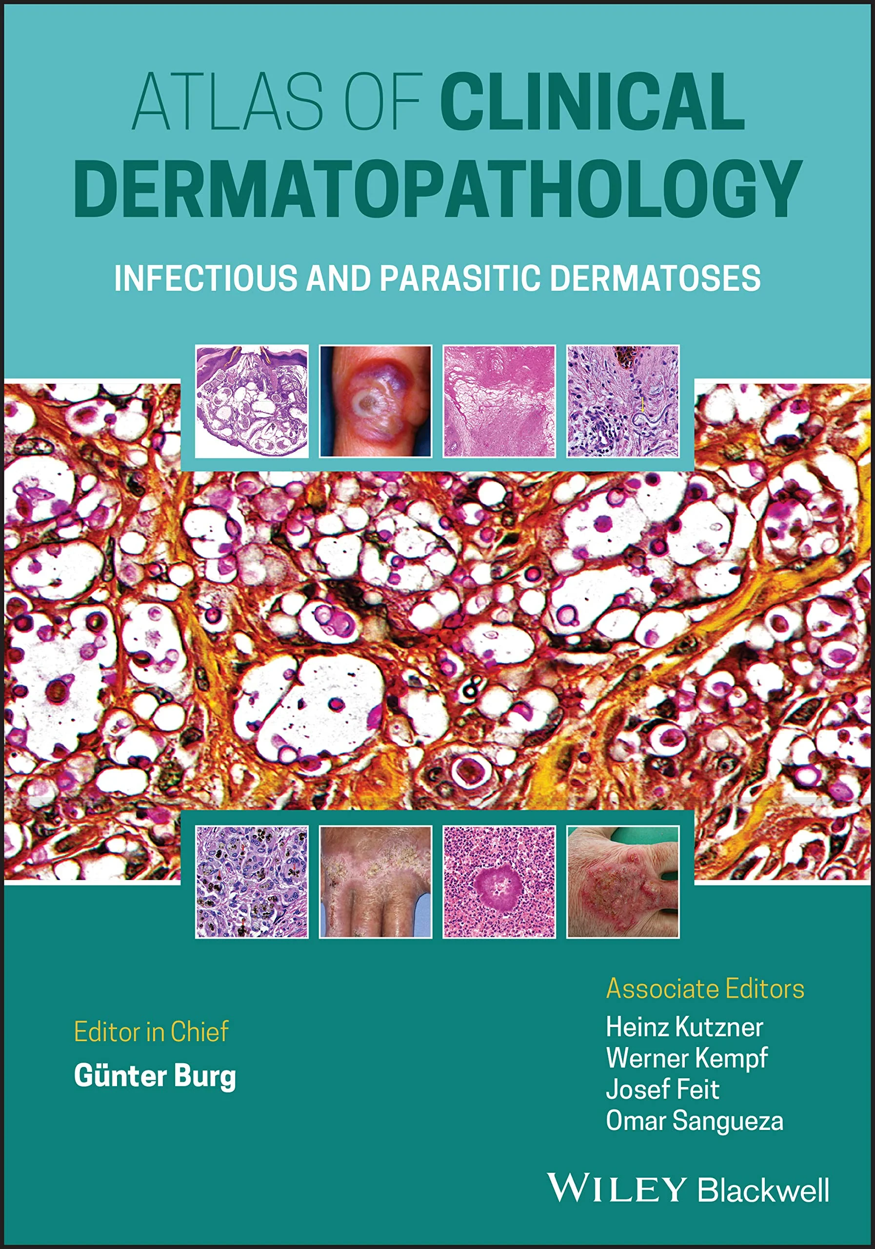 Coperta cărții "Atlas of Clinical Dermatopathology: Infectious and Parasitic Dermatoses" de Gunter Burg, Werner Kempf, Heinz Kutzner, Josef Feit