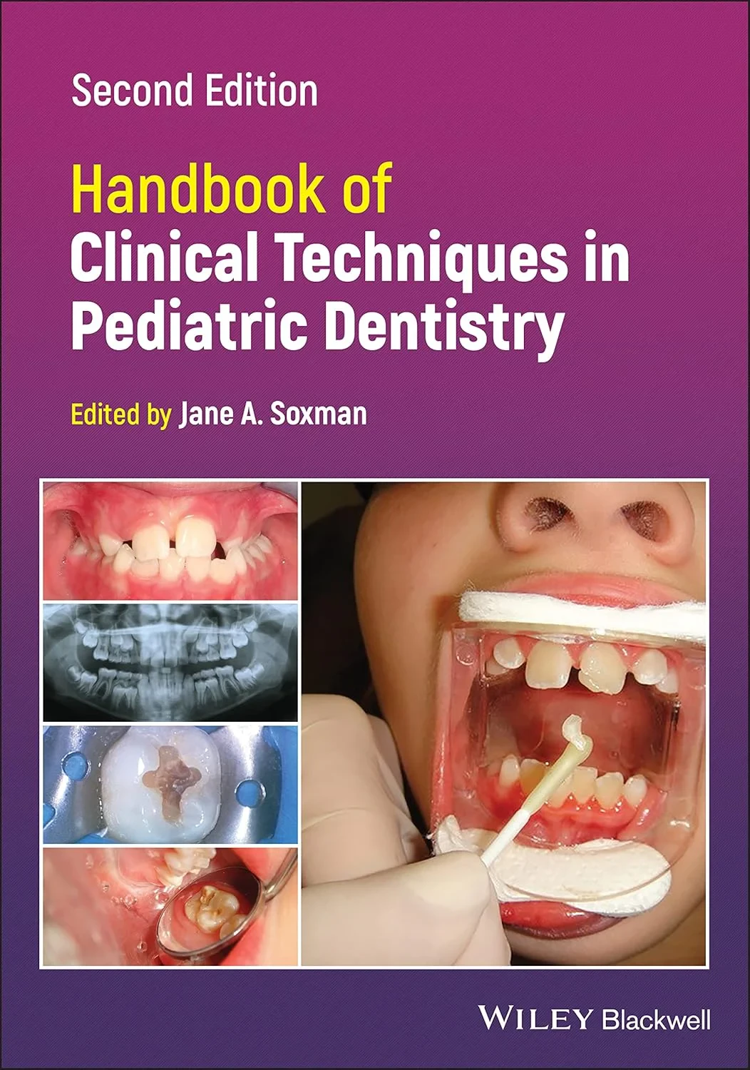 Coperta cărții "Handbook of Clinical Techniques in Pediatric Dentistry" de Jane A. Soxman