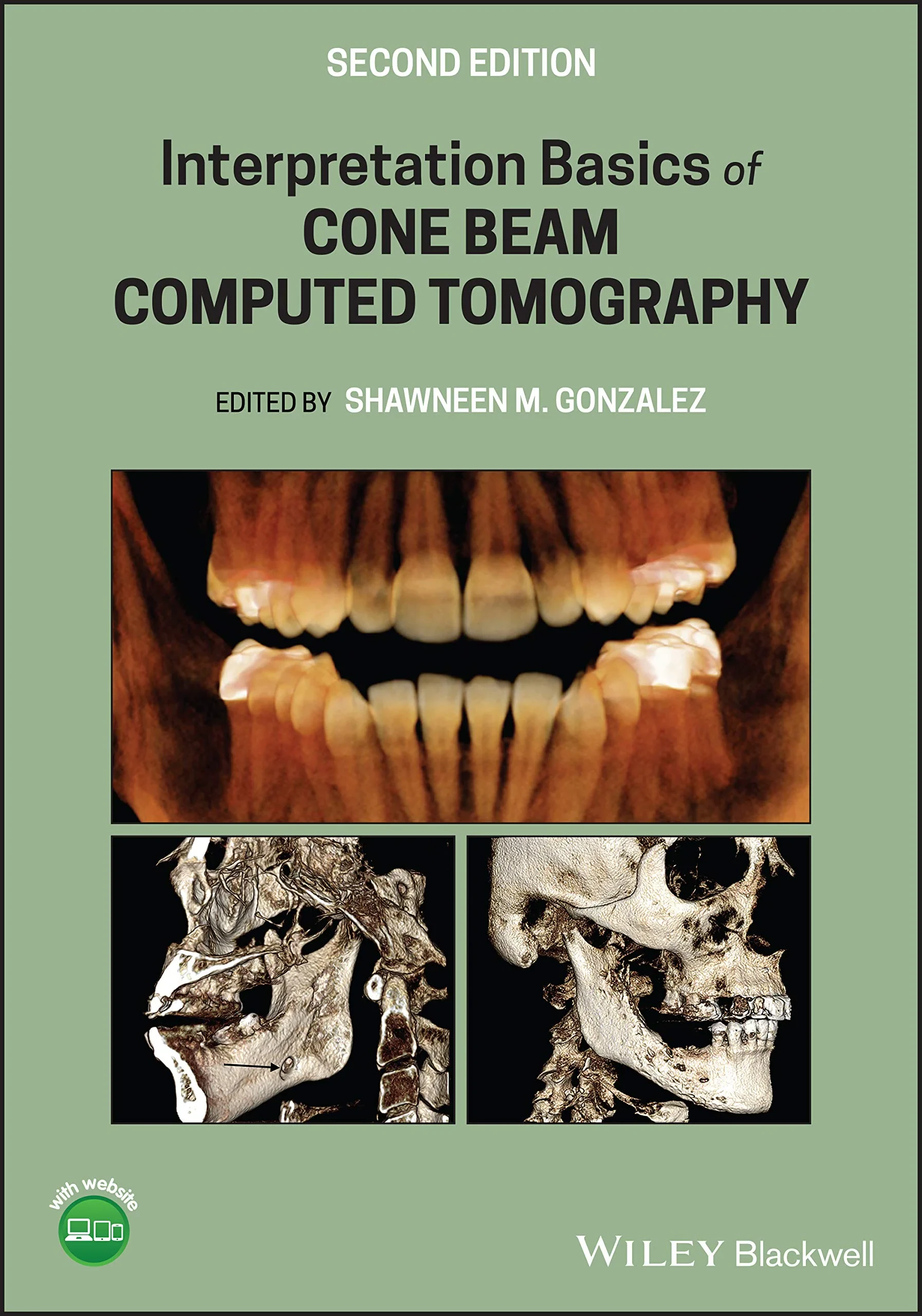 Coperta cărții "Interpretation Basics of Cone Beam Computed Tomography" de Shawneen M. Gonzalez