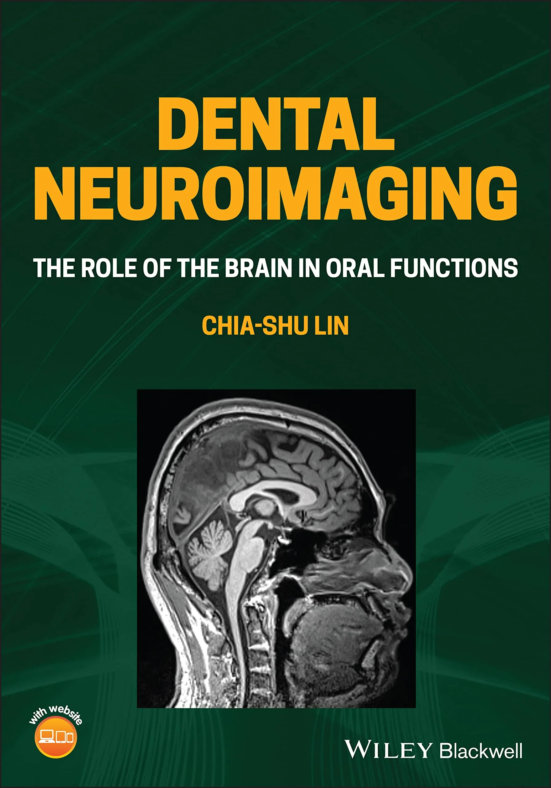 Dental Neuroimaging: The Role of the Brain in Oral...