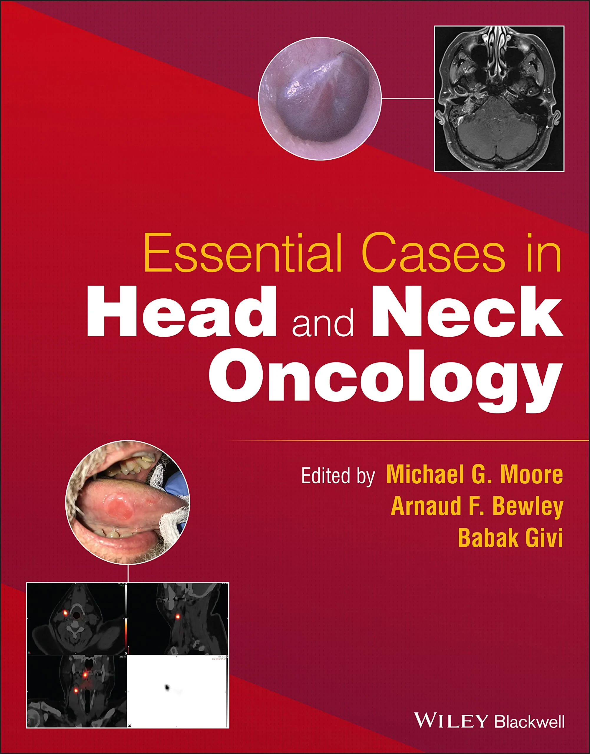 Coperta cărții "Essential Cases in Head and Neck Oncology" de Michael G. Moore, Arnaud F. Bewley, Babak Givi