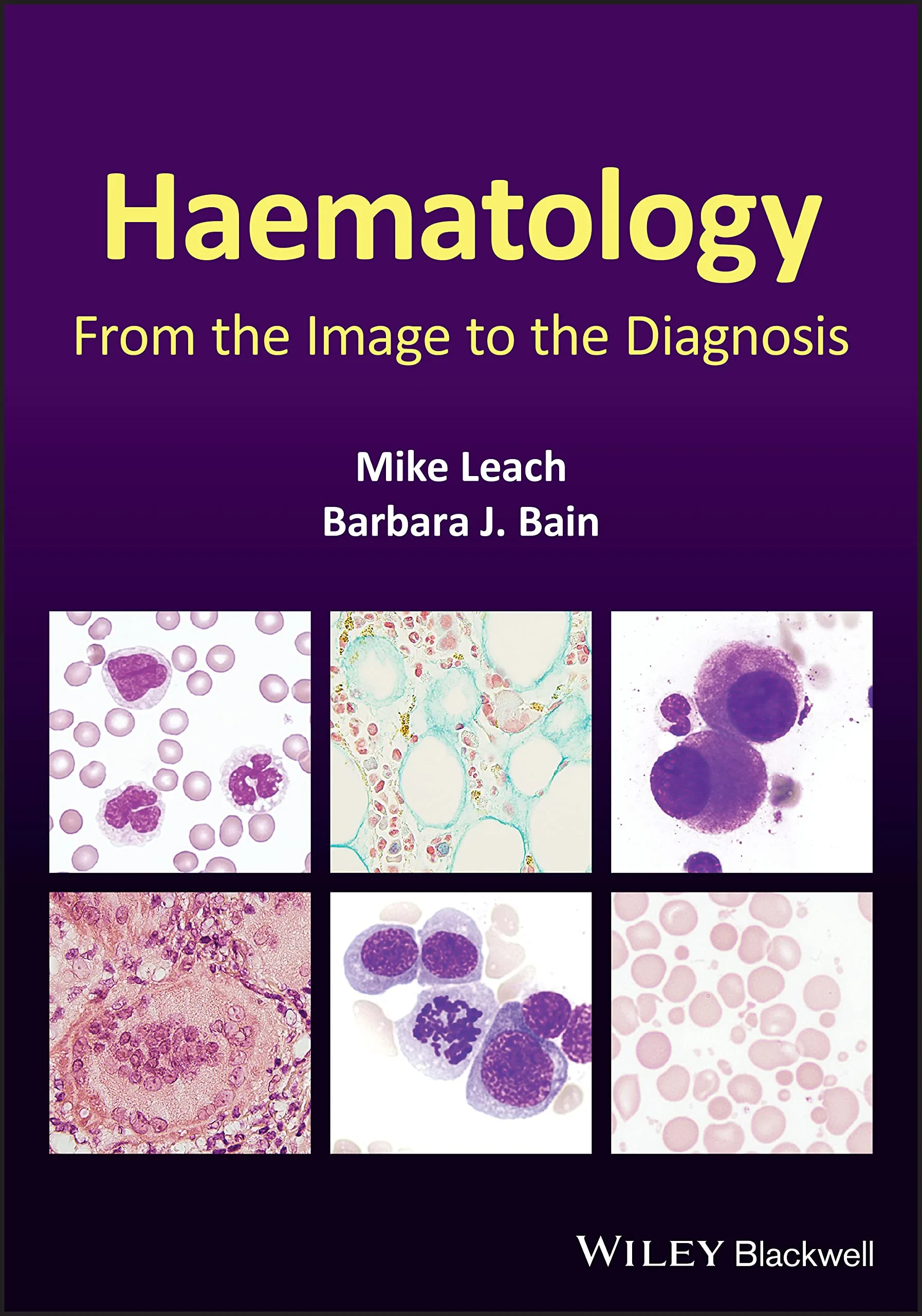 Coperta cărții "Haematology: From the Image to the Diagnosis" de Barbara J. Bain, Mike Leach