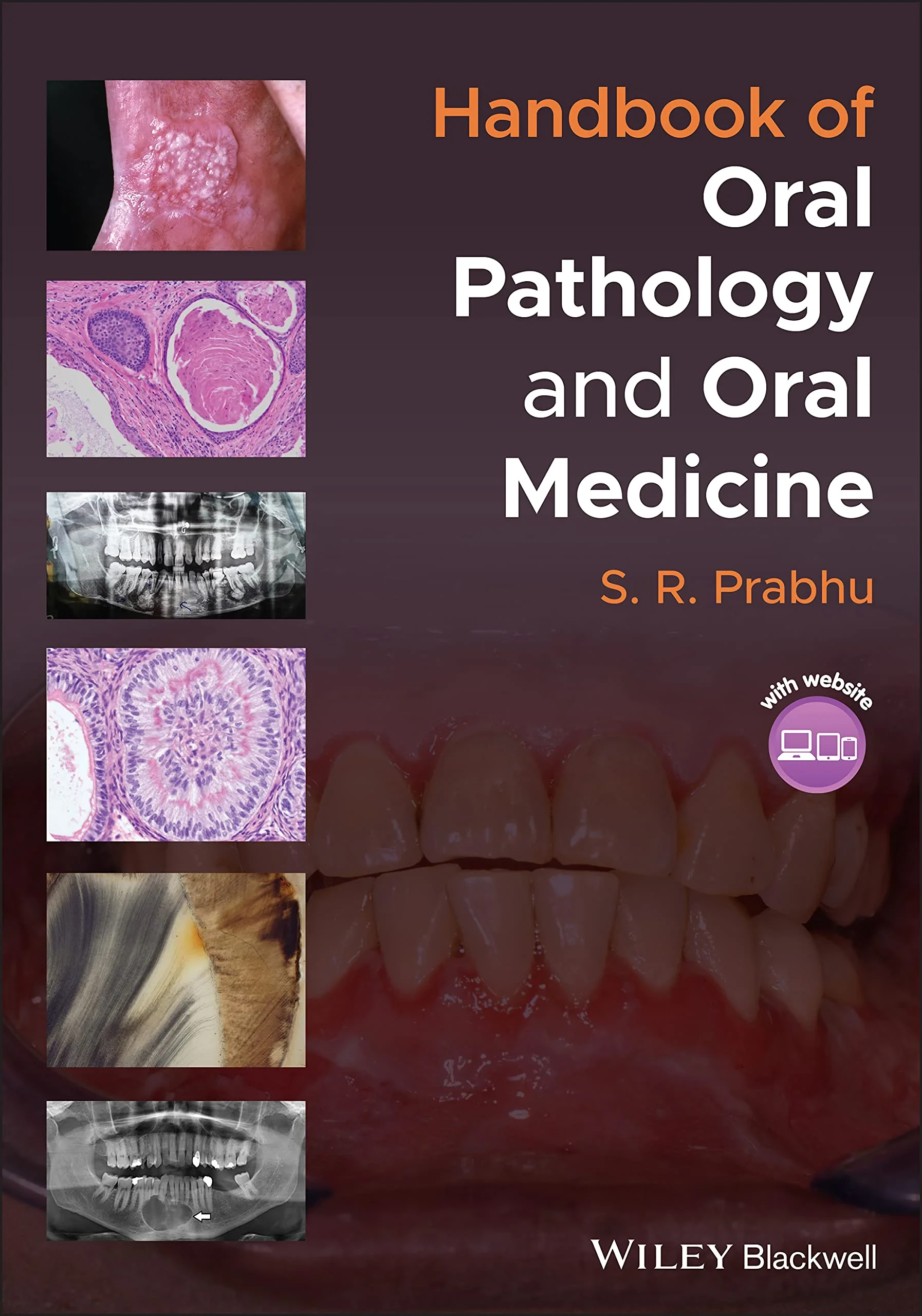 Coperta cărții "Handbook of Oral Pathology and Oral Medicine" de S. R. Prabhu