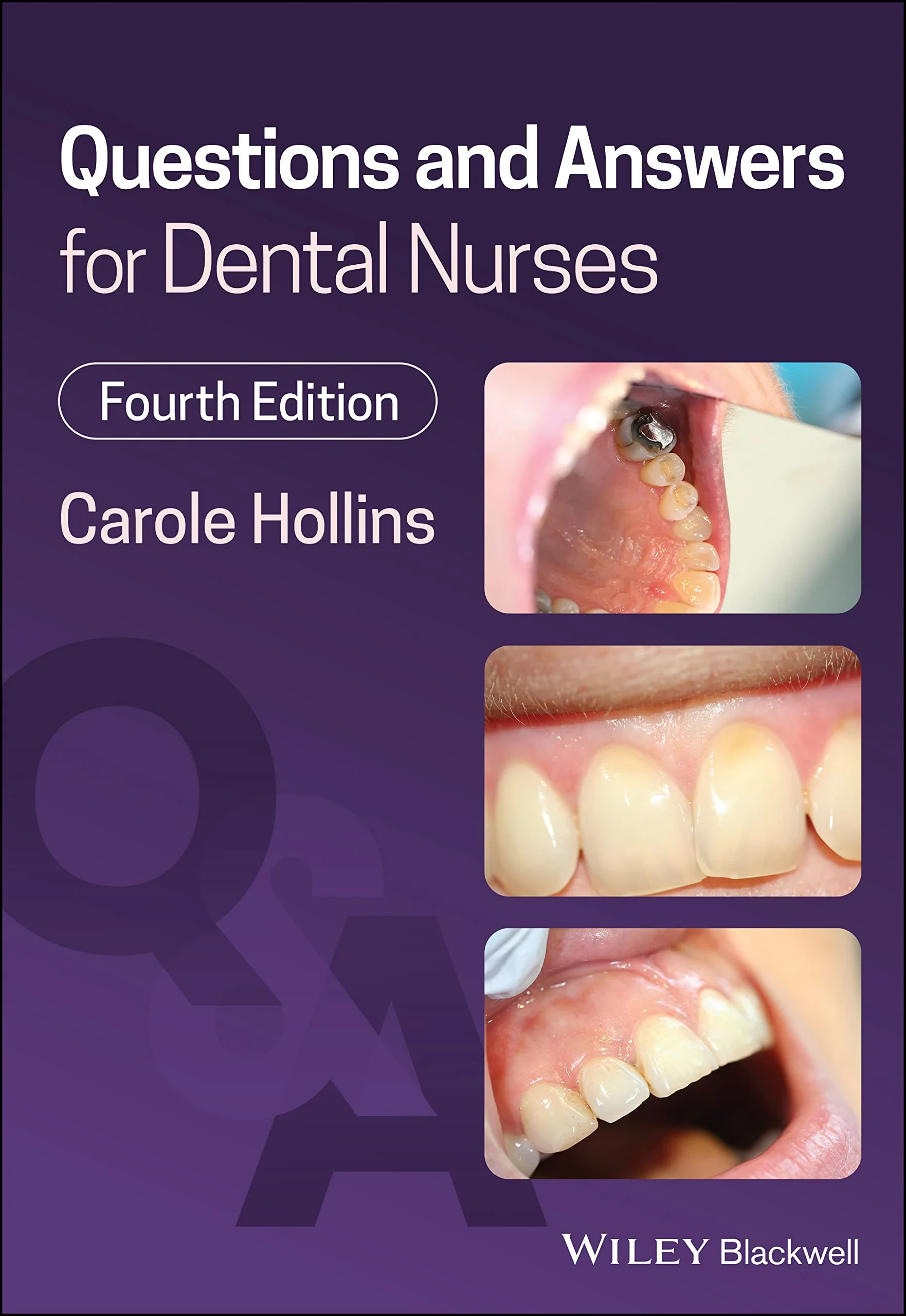 Coperta cărții "Questions and Answers for Dental Nurses " de Carole Hollins