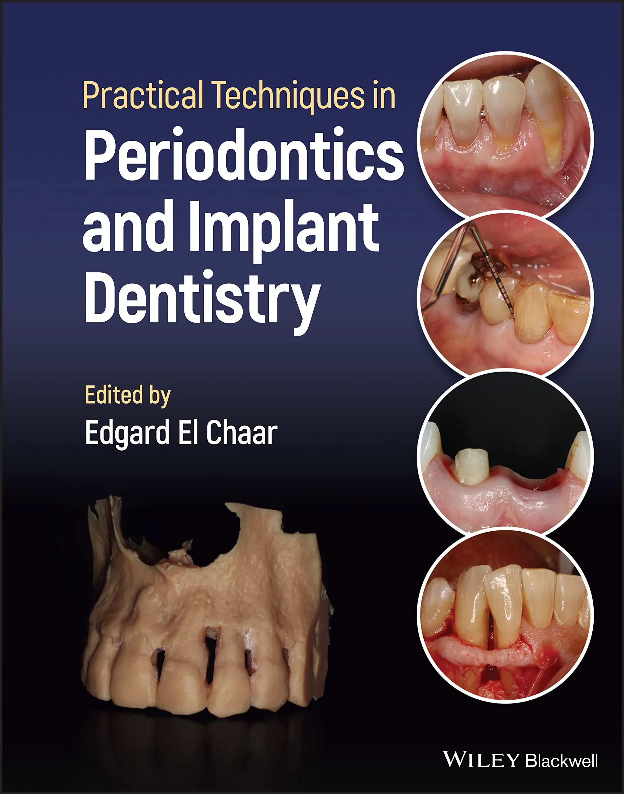Coperta cărții "Practical Techniques in Periodontics and Implant Dentistry" de E El Chaar