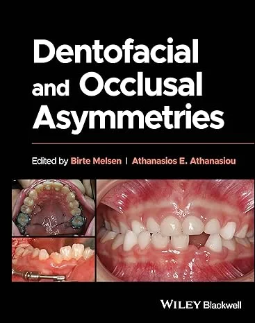 Coperta cărții "Dentofacial and Occlusal Asymmetries" de Birte Melsen, Athanasios E. Athanasiou