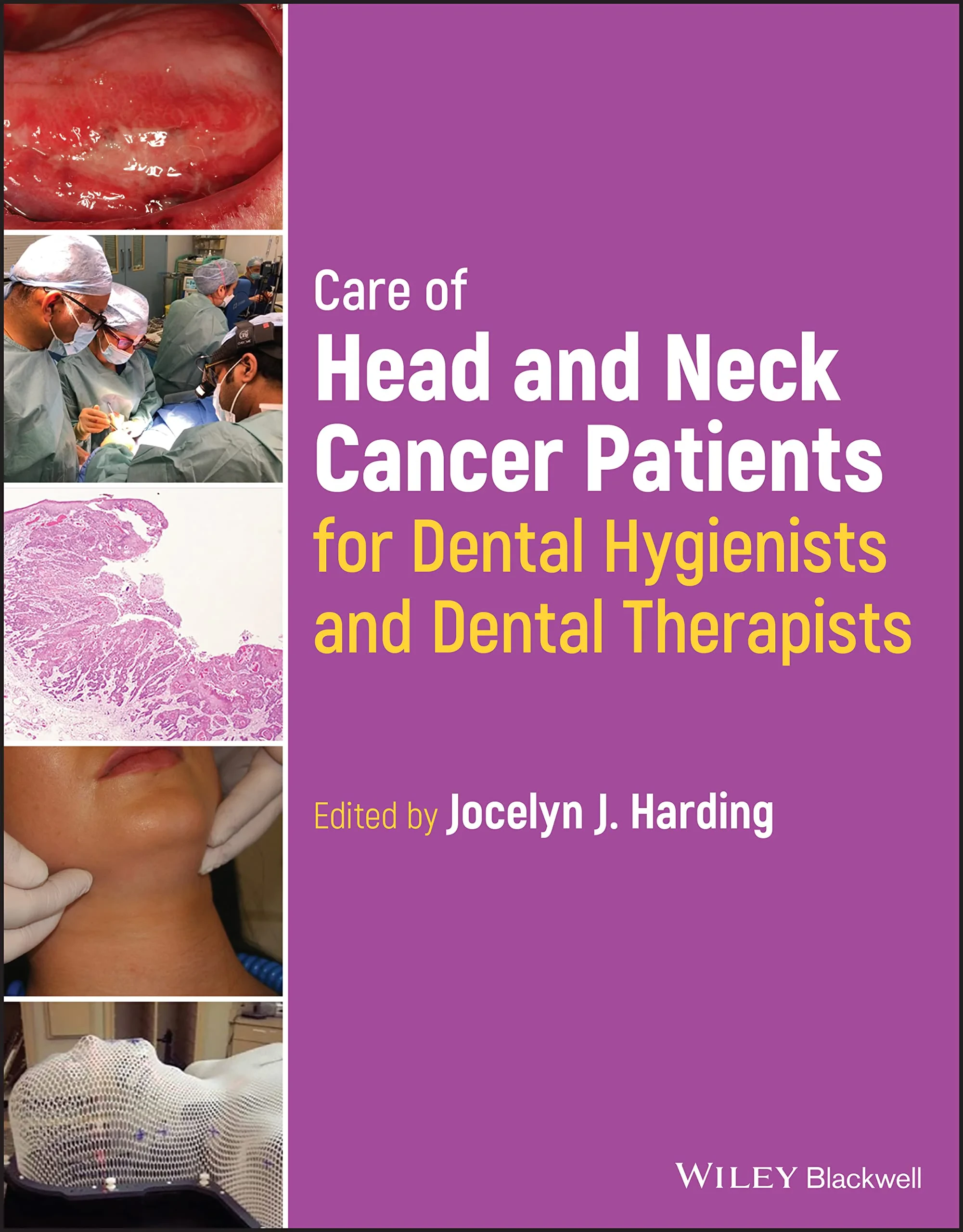 Coperta cărții "Care of Head and Neck Cancer Patients for Dental Hygienists and Dental Therapists" de Jocelyn J. Harding