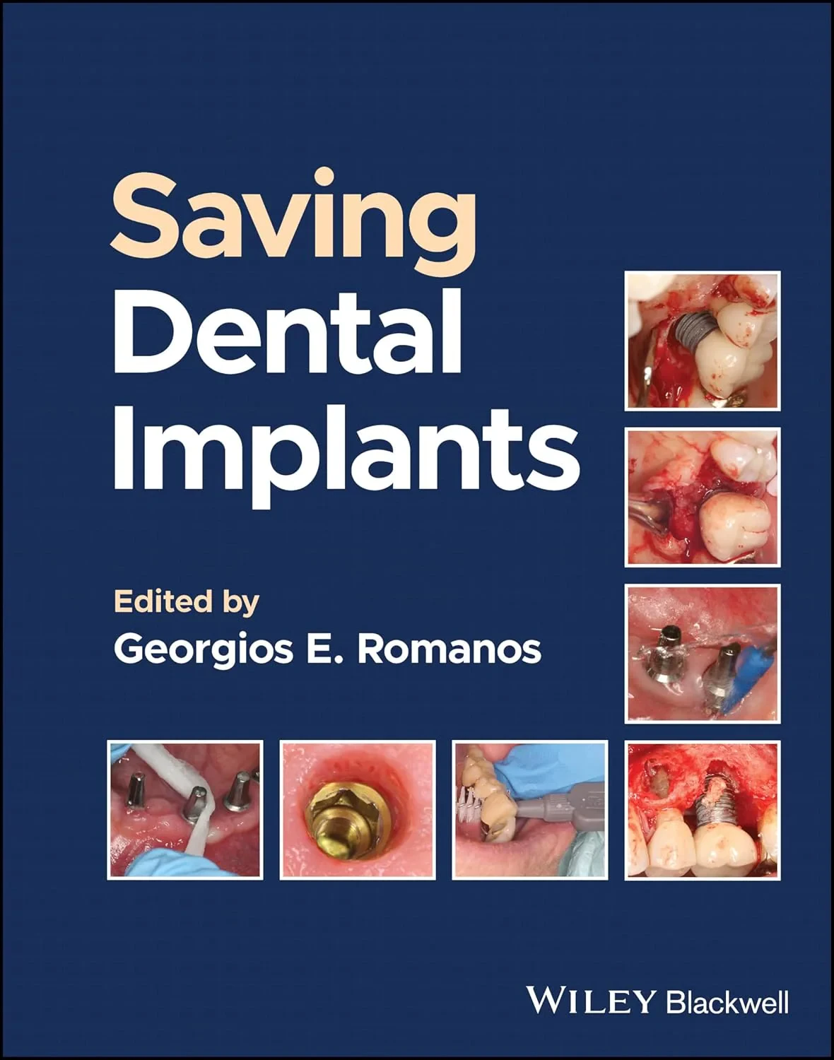 Saving Dental Implants