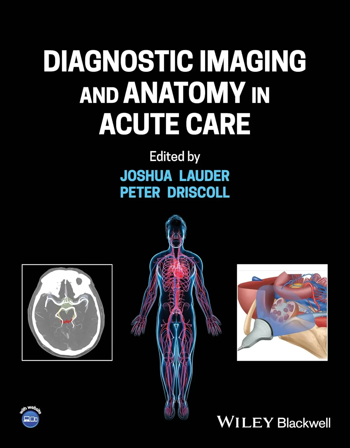 Coperta cărții "Diagnostic Imaging and Anatomy in Acute Care " de Driscoll
