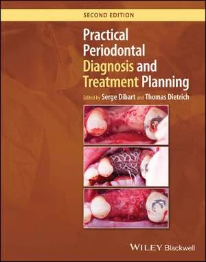 Coperta cărții "Practical Periodontal Diagnosis and Treatment Planning" de Dibart