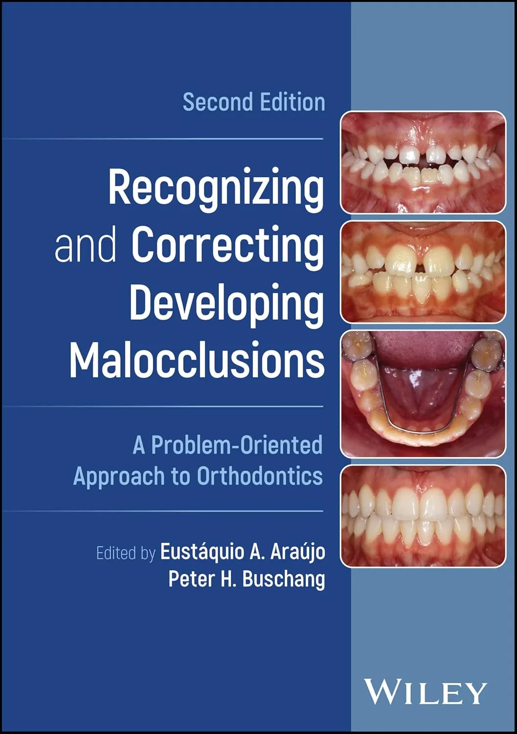 Coperta cărții "Recognizing and Correcting Developing Malocclusions: A Problem-Oriented Approach to Orthodontics" de Eustaquio A. Araujo, Peter H. Buschang