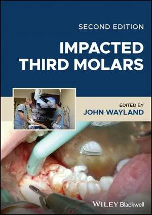 Coperta cărții "Impacted Third Molars, 2nd Edition" de J Wayland