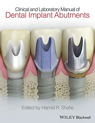 Coperta cărții "Clinical and Laboratory Manual of Dental Implant Abutments" de Hamid R. Shafie