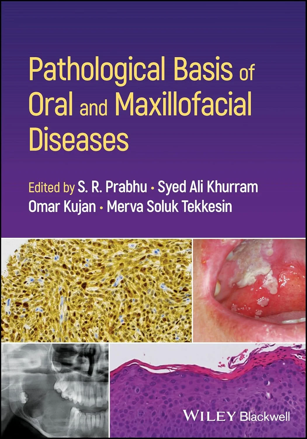 Coperta cărții "Pathological Basis of Oral and Maxillofacial Diseases" de S R Prabhu, Syed Ali Khurram, Omar Kujan, Merva Soluk Tekkesin