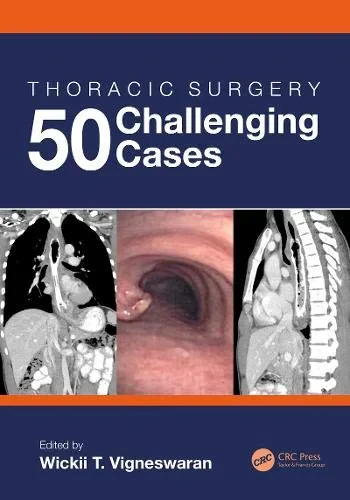 Coperta cărții "Thoracic Surgery: 50 Challenging cases" de Wickii Vigneswaran