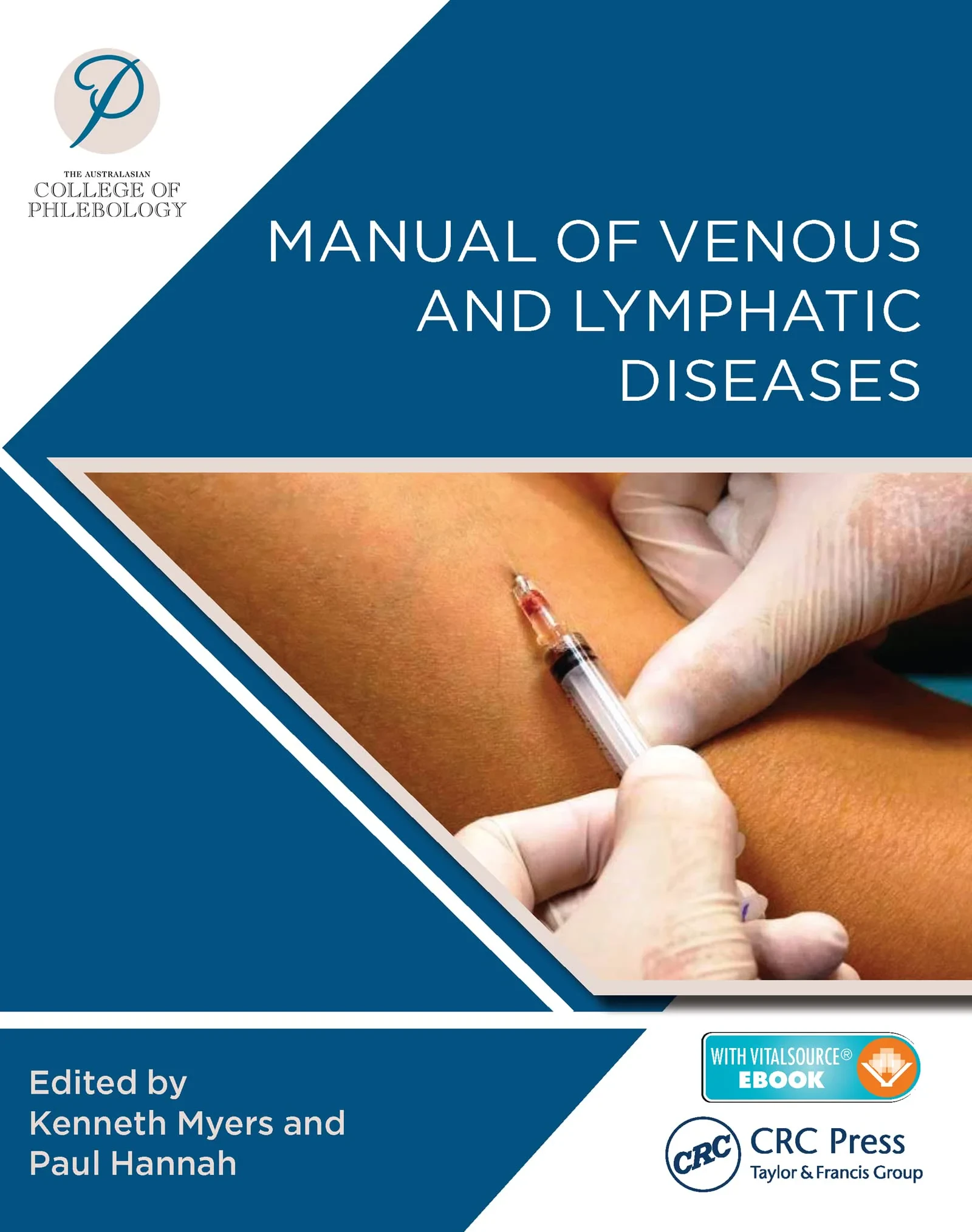 Coperta cărții "Manual of Venous and Lymphatic Diseases " de Australasian College of Phlebology