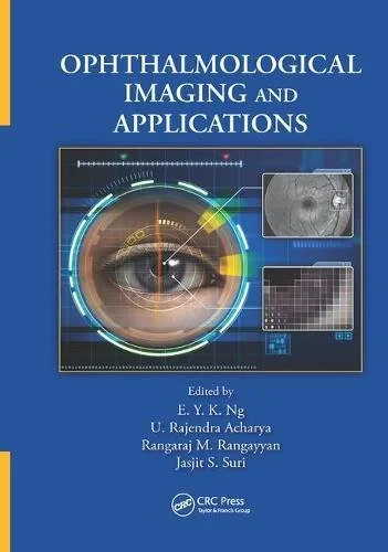 Coperta cărții "Ophthalmological Imaging and Applications" de Jasjit S. Suri, E. Y. K. Ng, U. Rajendra Acharya, Rangaraj M. Rangayyan