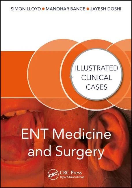 Coperta cărții "ENT Medicine and Surgery: Illustrated Clinical Cases" de Simon Kinglsey Wickham Lloyd, Manohar Bance, Jayesh Doshi