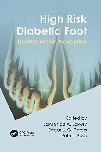 Coperta cărții "High Risk Diabetic Foot: Treatment and Prevention" de Lawrence A. Lavery, Edgar J G. Peters, Ruth Bush