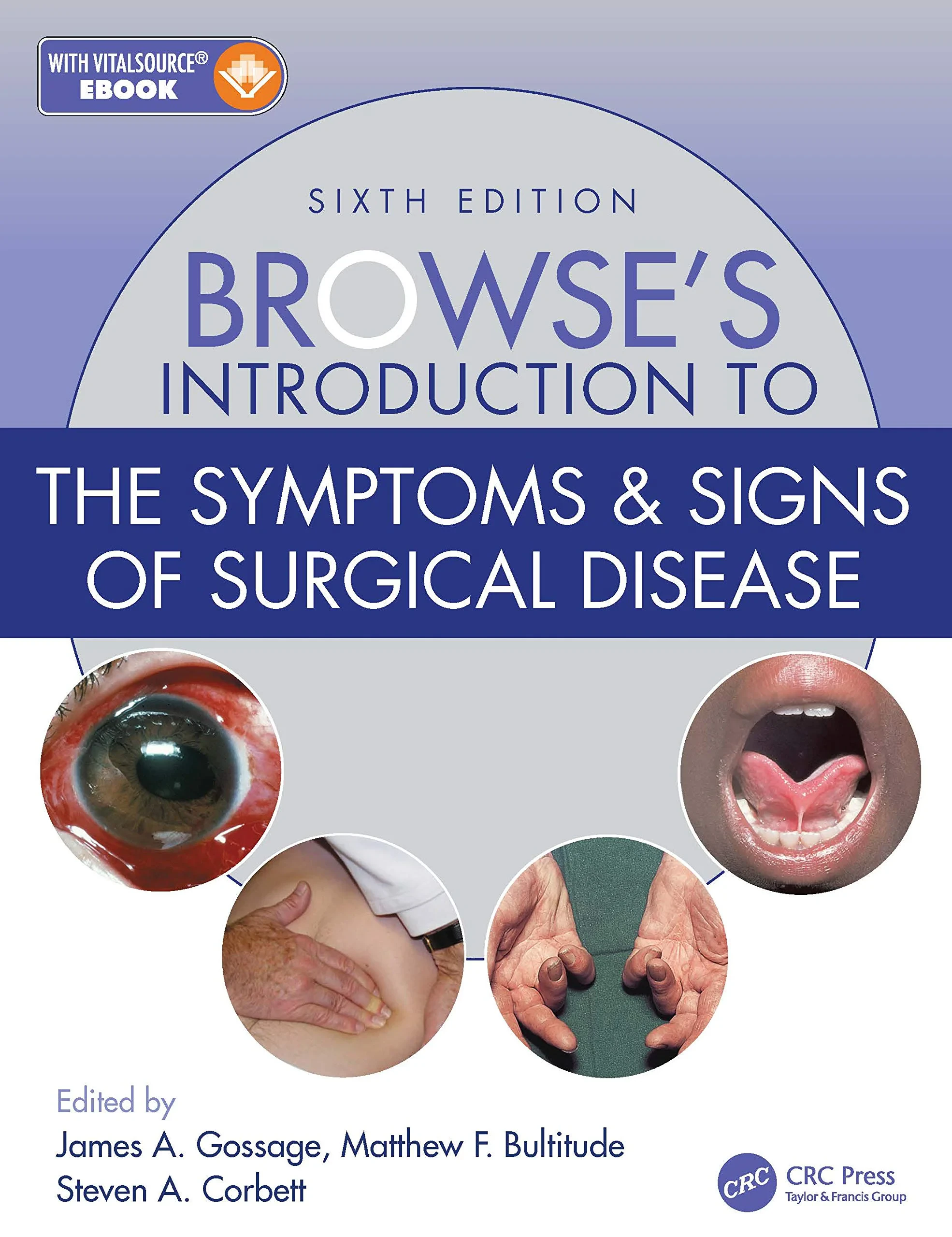 Coperta cărții "Browse’s Introduction to the Symptoms &amp; Signs of Surgical Disease" de James A. Gossage