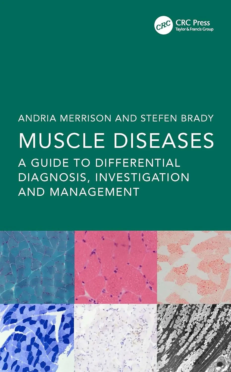 Coperta cărții "Muscle Diseases A Guide to Differential Diagnosis, Investigation and Management" de Andria Merrison, Stefen Brady
