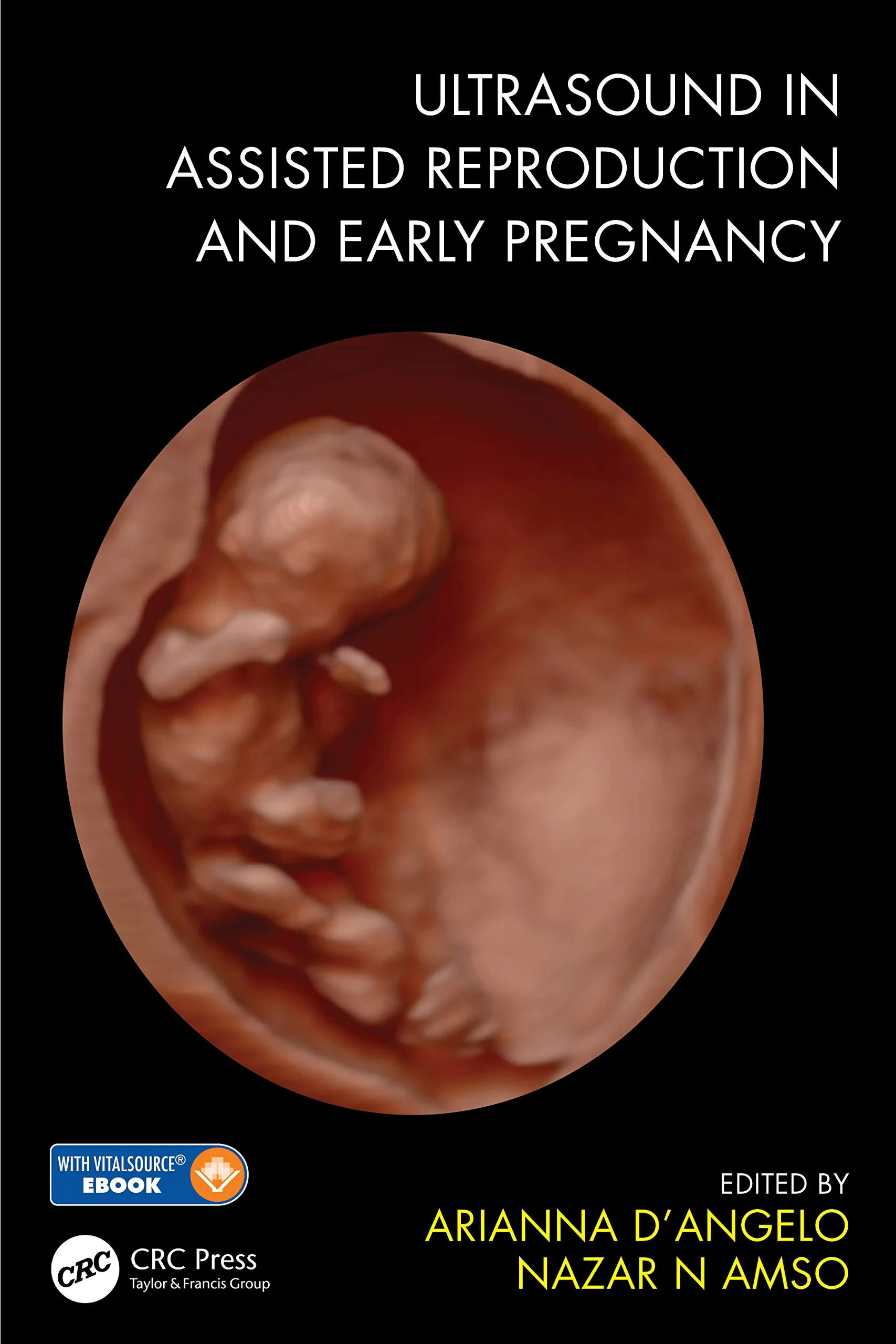 Coperta cărții "Ultrasound in Assisted Reproduction and Early Pregnancy" de Arianna D'Angelo (Editor), Nazar N. Amso
