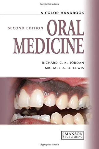 Coperta cărții "Oral Medicine (Medical Color Handbook Series) " de Michael A.O. Lewis, Richard C.K. Jordan
