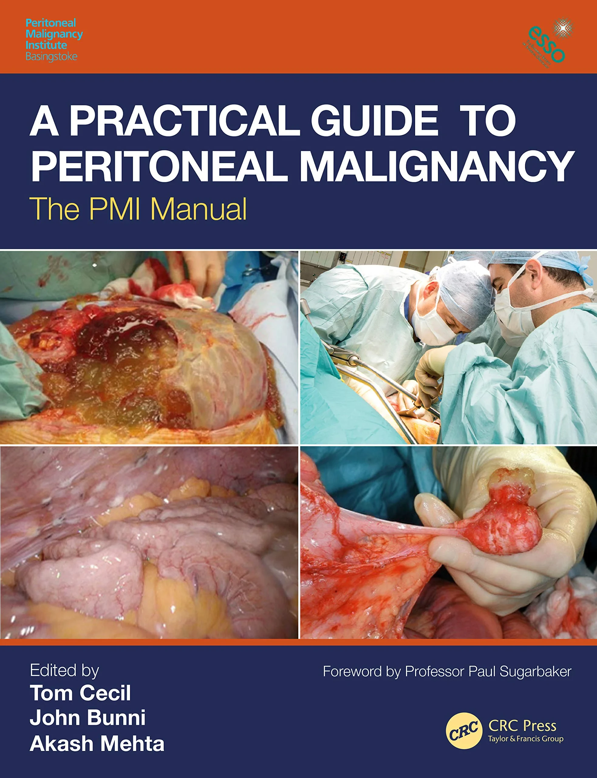 Coperta cărții "A Practical Guide to Peritoneal Malignancy: The PMI Manual" de Tom Cecil, John Bunni, Akash Mehta