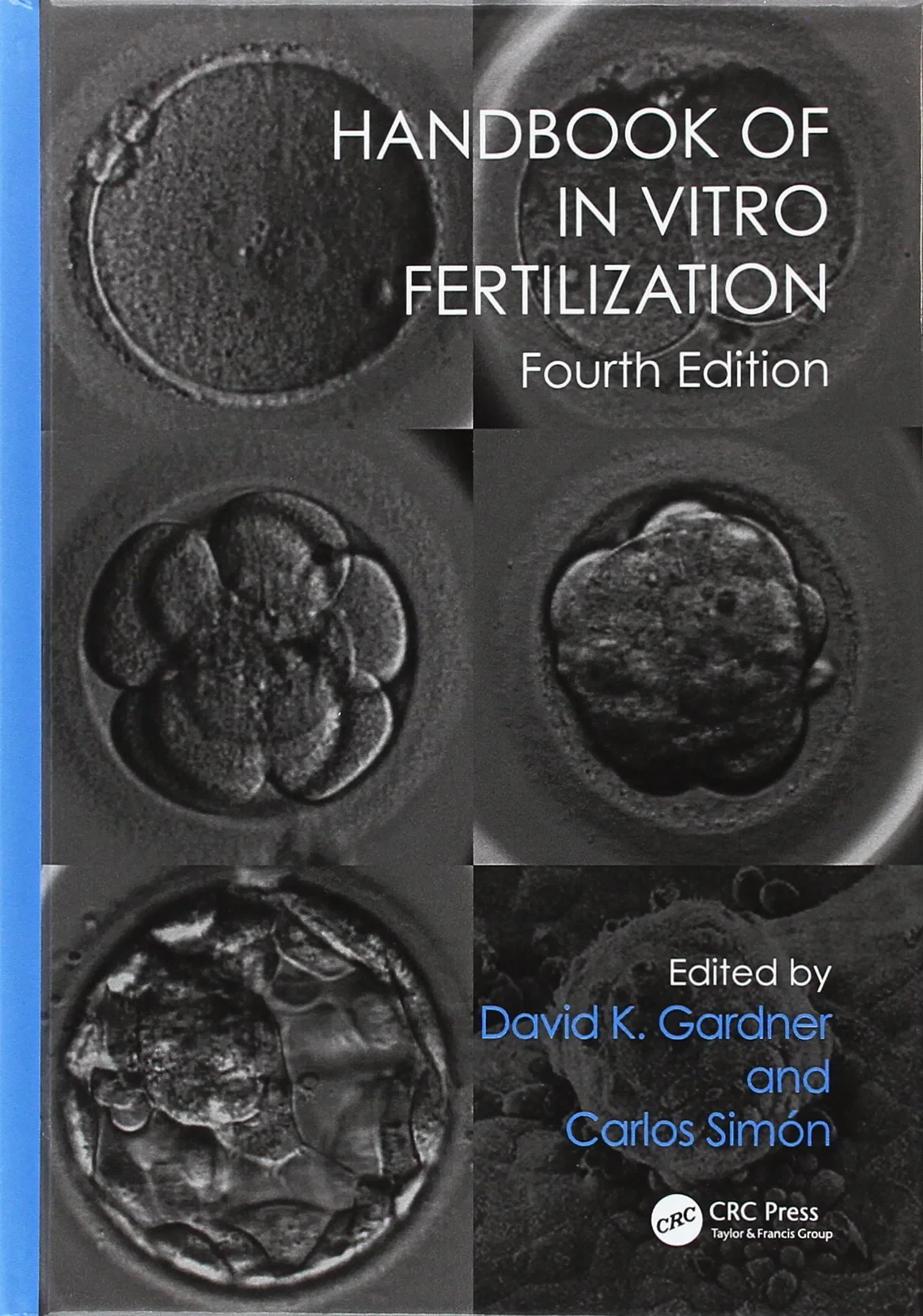 Handbook of In Vitro Fertilization, Fourth Edition