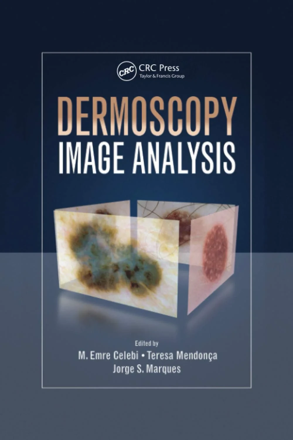 Coperta cărții "Dermoscopy Image Analysis " de M. Emre Celebi, Teresa Mendonca, Jorge S. Marques