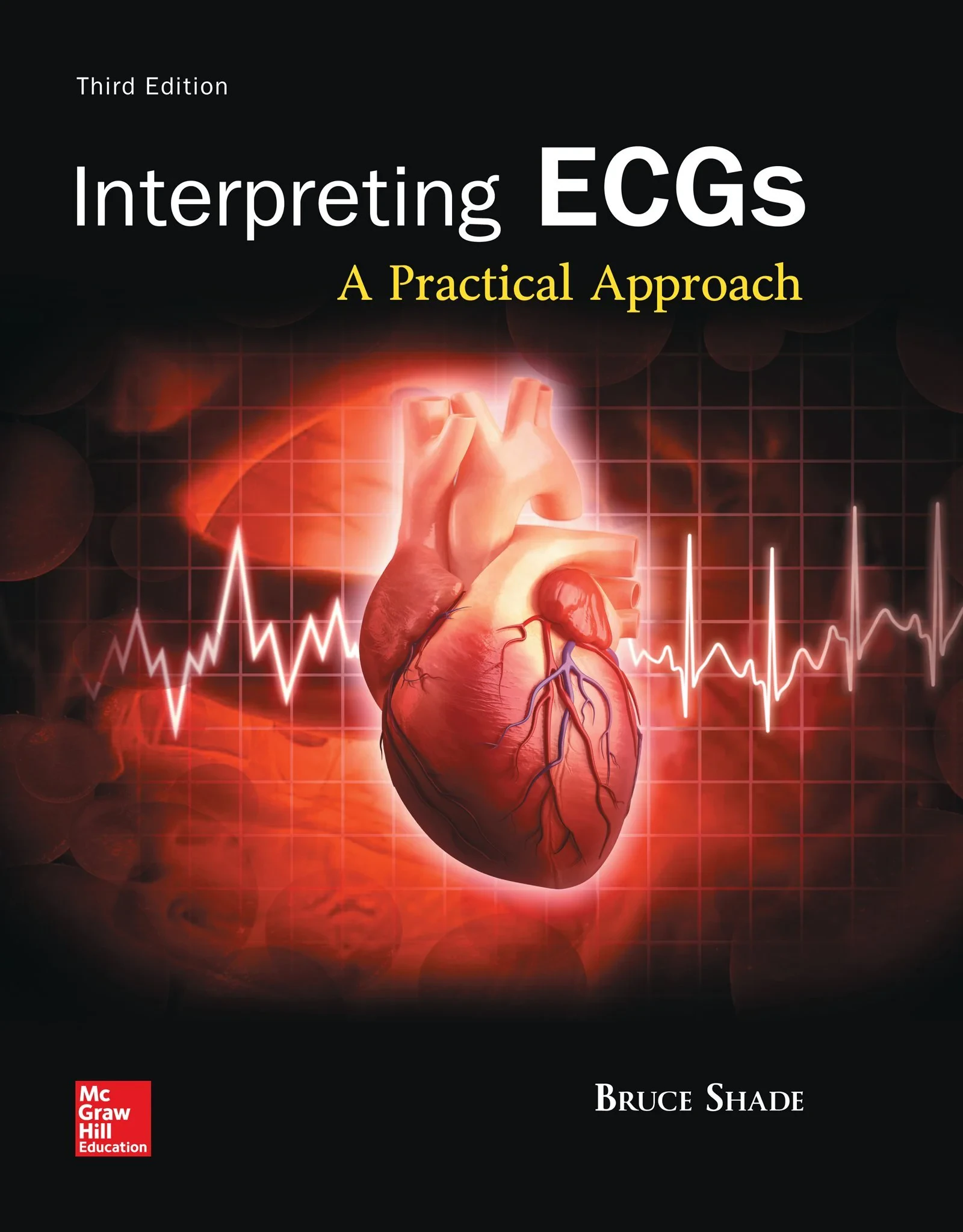 Coperta cărții "Interpreting ECGs: A Practical Approach" de Bruce Shade