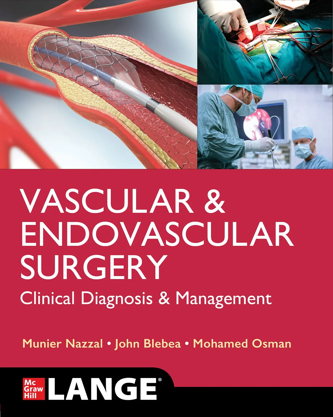 Coperta cărții "Vascular and Endovascular Surgery: Clinical Diagnosis and Management" de Munier Nazzal, John Blebea, Mohamed Osman