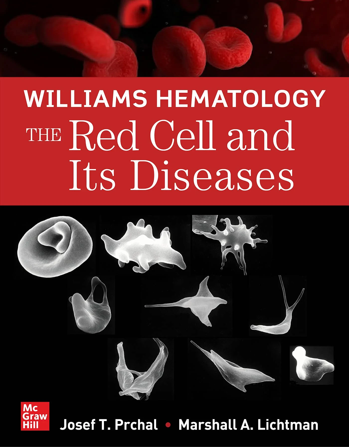 Coperta cărții "Williams Hematology: The Red Cell and Its Diseases" de Marshall Lichtman, Josef Prchal